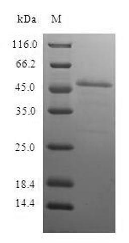 (Tris-Glycine gel) Discontinuous SDS-PAGE (reduced) with 5% enrichment gel and 15% separation gel.