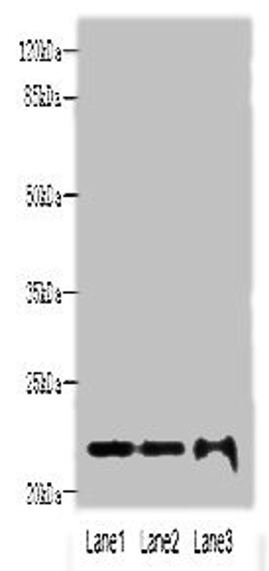 Western blot. All lanes: MRPS18A antibody at 6ug/ml. Lane 1: HL60 whole cell lysate. Lane 2: A549 whole cell lysate. Lane 3: HepG2 whole cell lysate. Secondary. Goat polyclonal to rabbit IgG at 1/10000 dilution. Predicted band size: 23, 31, 15 kDa. Observed band size: 23 kDa. 