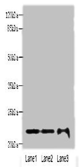 Western blot. All lanes: MRPS18A antibody at 6ug/ml. Lane 1: HL60 whole cell lysate. Lane 2: A549 whole cell lysate. Lane 3: HepG2 whole cell lysate. Secondary. Goat polyclonal to rabbit IgG at 1/10000 dilution. Predicted band size: 23, 31, 15 kDa. Observed band size: 23 kDa. 