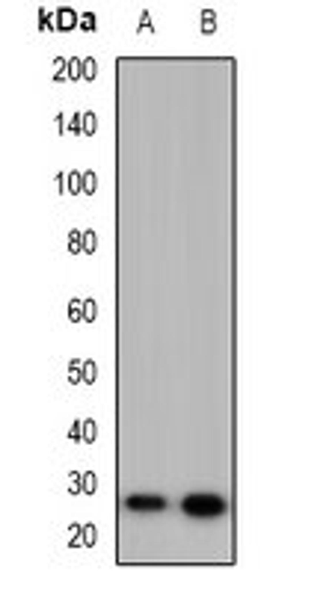 Western blot analysis of HeLa (Lane1), PC12 (Lane2) whole cell lysates using MARCH2 antibody