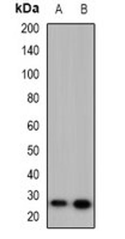 Western blot analysis of HeLa (Lane1), PC12 (Lane2) whole cell lysates using MARCH2 antibody