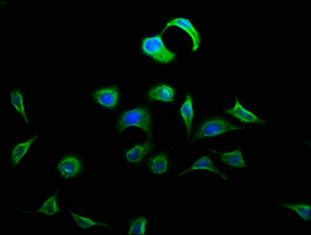 Immunofluorescence staining of A549 cells with CSB-PA007111LA01HU at 1:133, counter-stained with DAPI. The cells were fixed in 4% formaldehyde, permeabilized using 0.2% Triton X-100 and blocked in 10% normal Goat Serum. The cells were then incubated with the antibody overnight at 4°C. The secondary antibody was Alexa Fluor 488-congugated AffiniPure Goat Anti-Rabbit IgG(H+L).