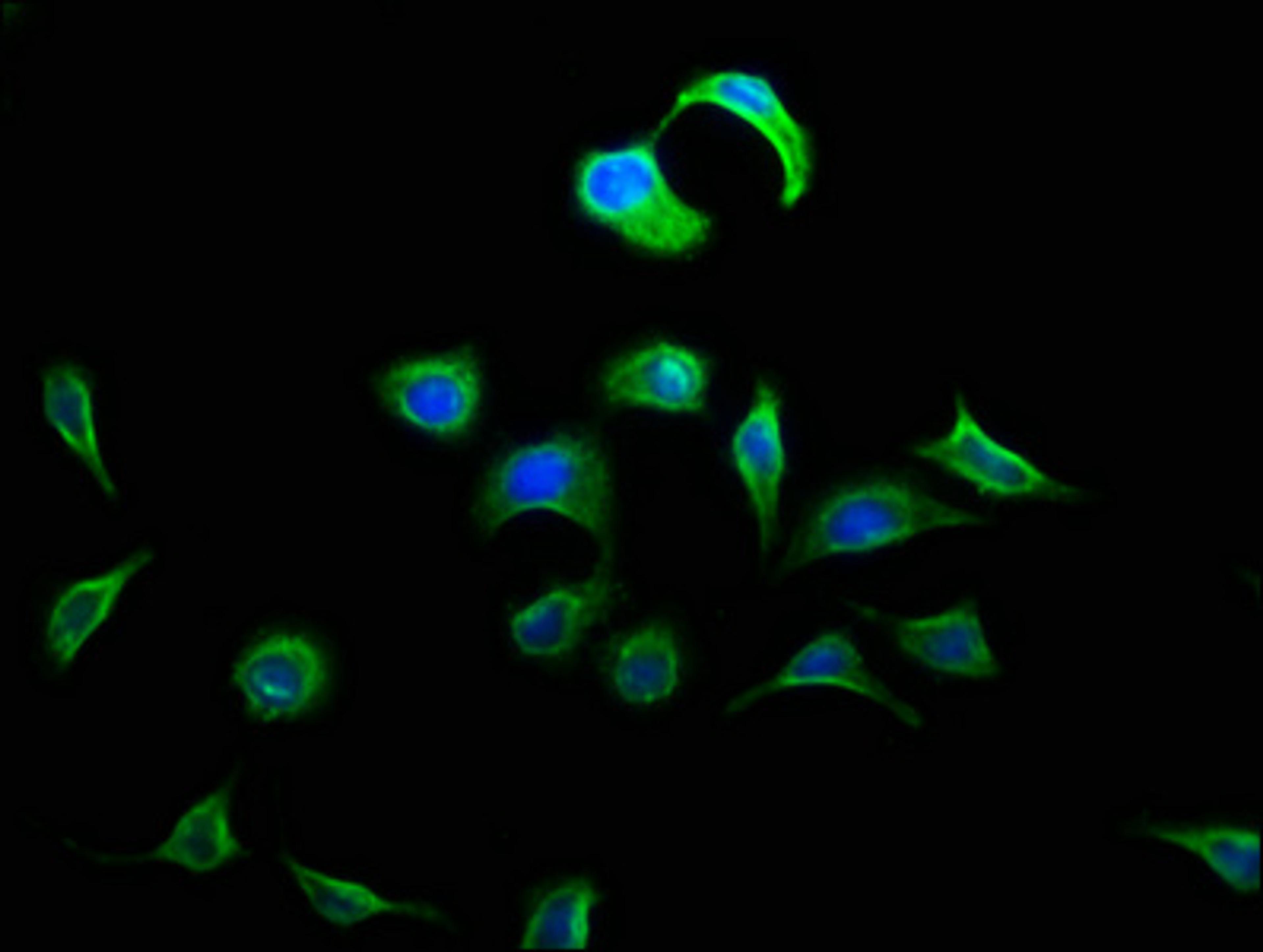 Immunofluorescence staining of A549 cells with CSB-PA007111LA01HU at 1:133, counter-stained with DAPI. The cells were fixed in 4% formaldehyde, permeabilized using 0.2% Triton X-100 and blocked in 10% normal Goat Serum. The cells were then incubated with the antibody overnight at 4°C. The secondary antibody was Alexa Fluor 488-congugated AffiniPure Goat Anti-Rabbit IgG(H+L).
