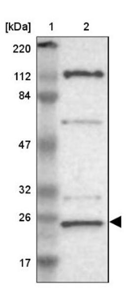 Western Blot: GCET2 Antibody [NBP1-82693] - Lane 1: Marker [kDa] 220, 112, 84, 47, 32, 26, 17<br/>Lane 2: Human cell line RT-4