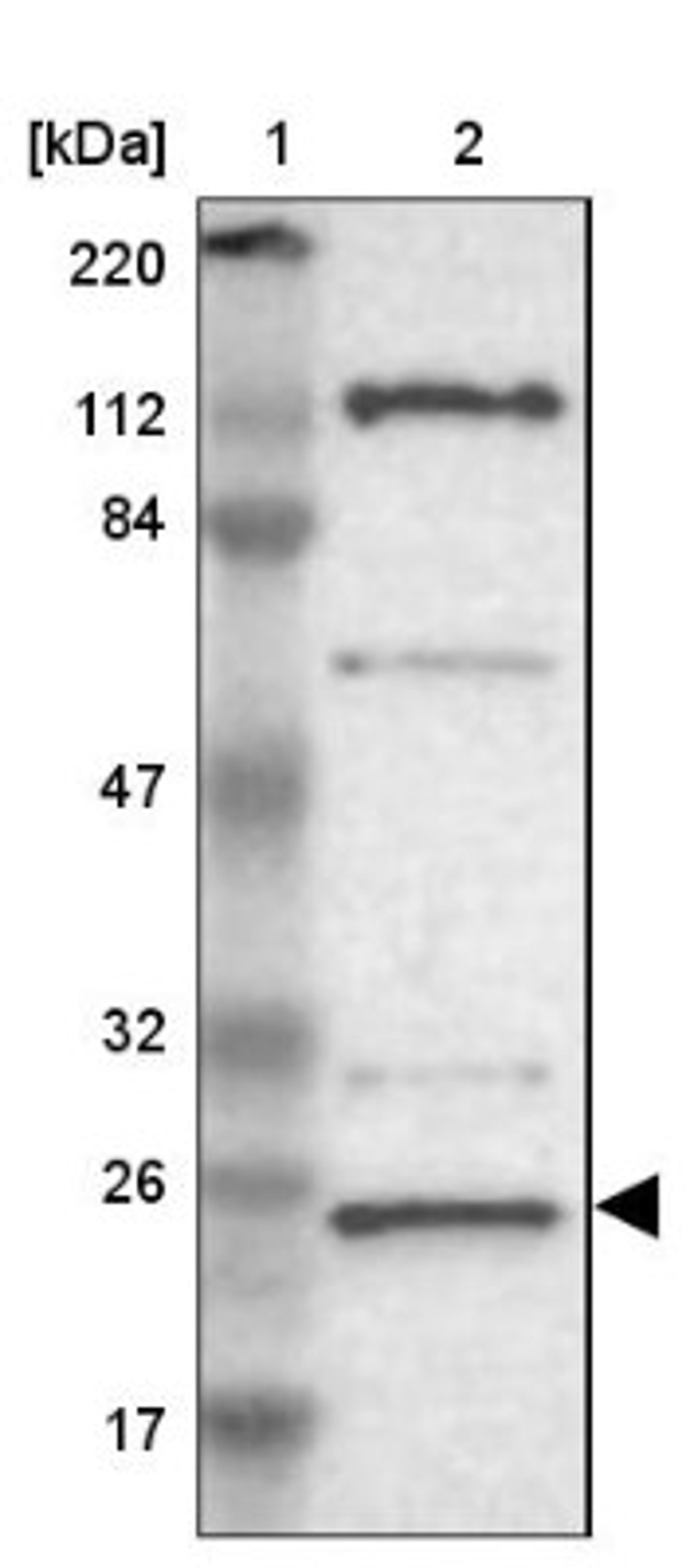 Western Blot: GCET2 Antibody [NBP1-82693] - Lane 1: Marker [kDa] 220, 112, 84, 47, 32, 26, 17<br/>Lane 2: Human cell line RT-4