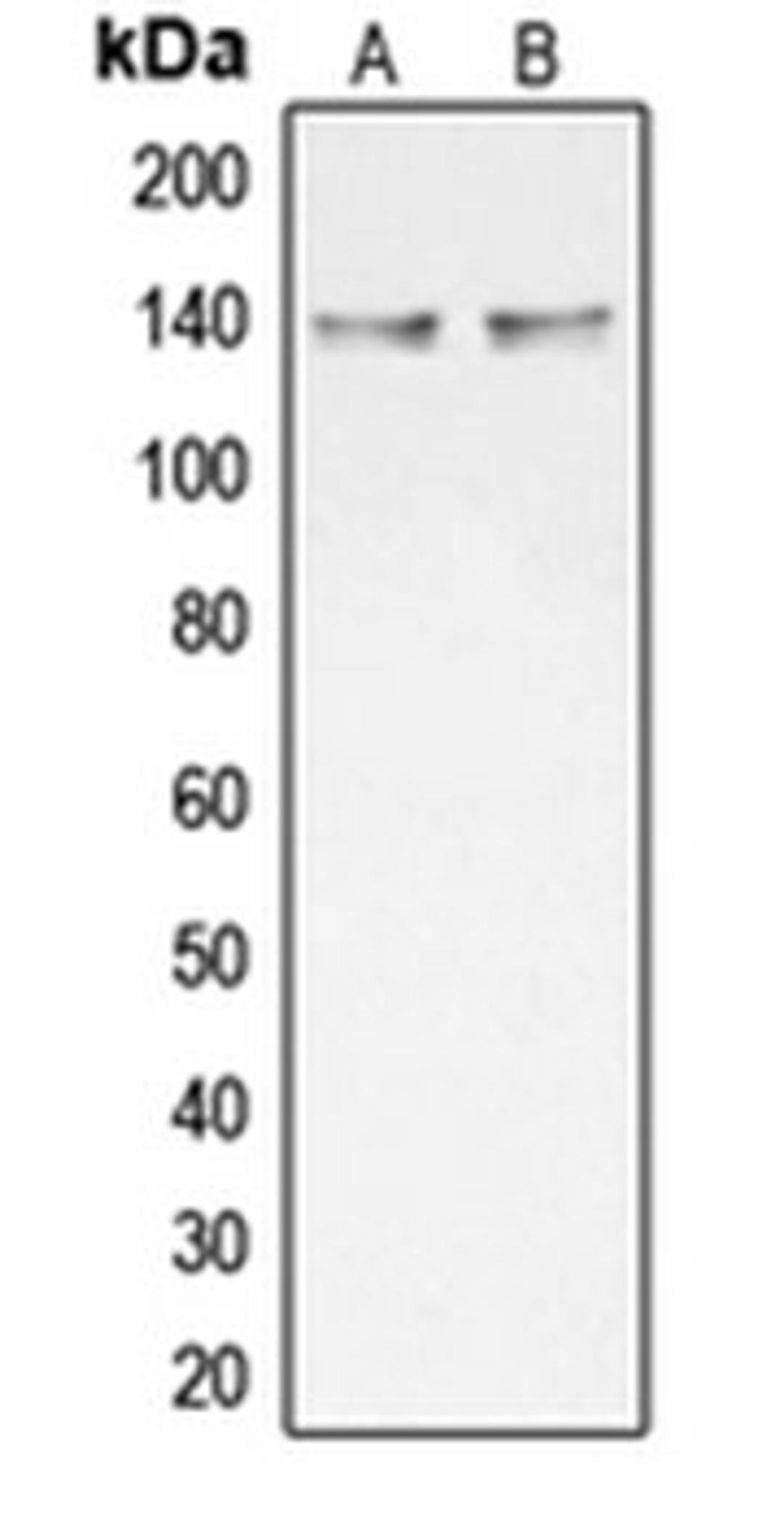 Western blot analysis of HT29 (Lane 1), NCIH292 (Lane 2) whole cell lysates using COL20A1 antibody