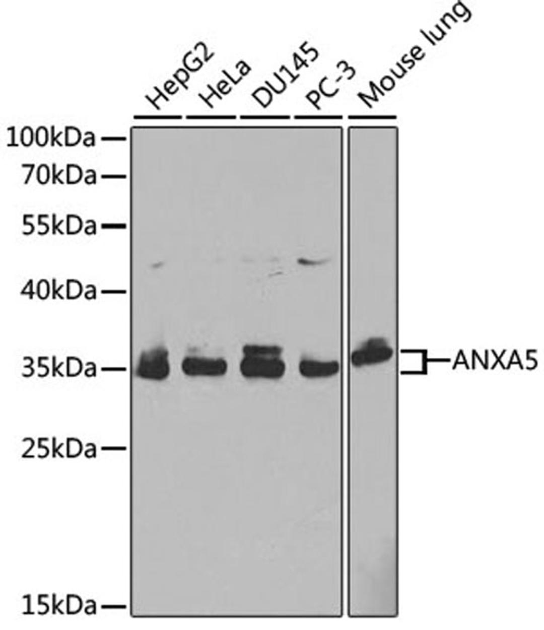 Western blot - ANXA5 antibody (A1728)