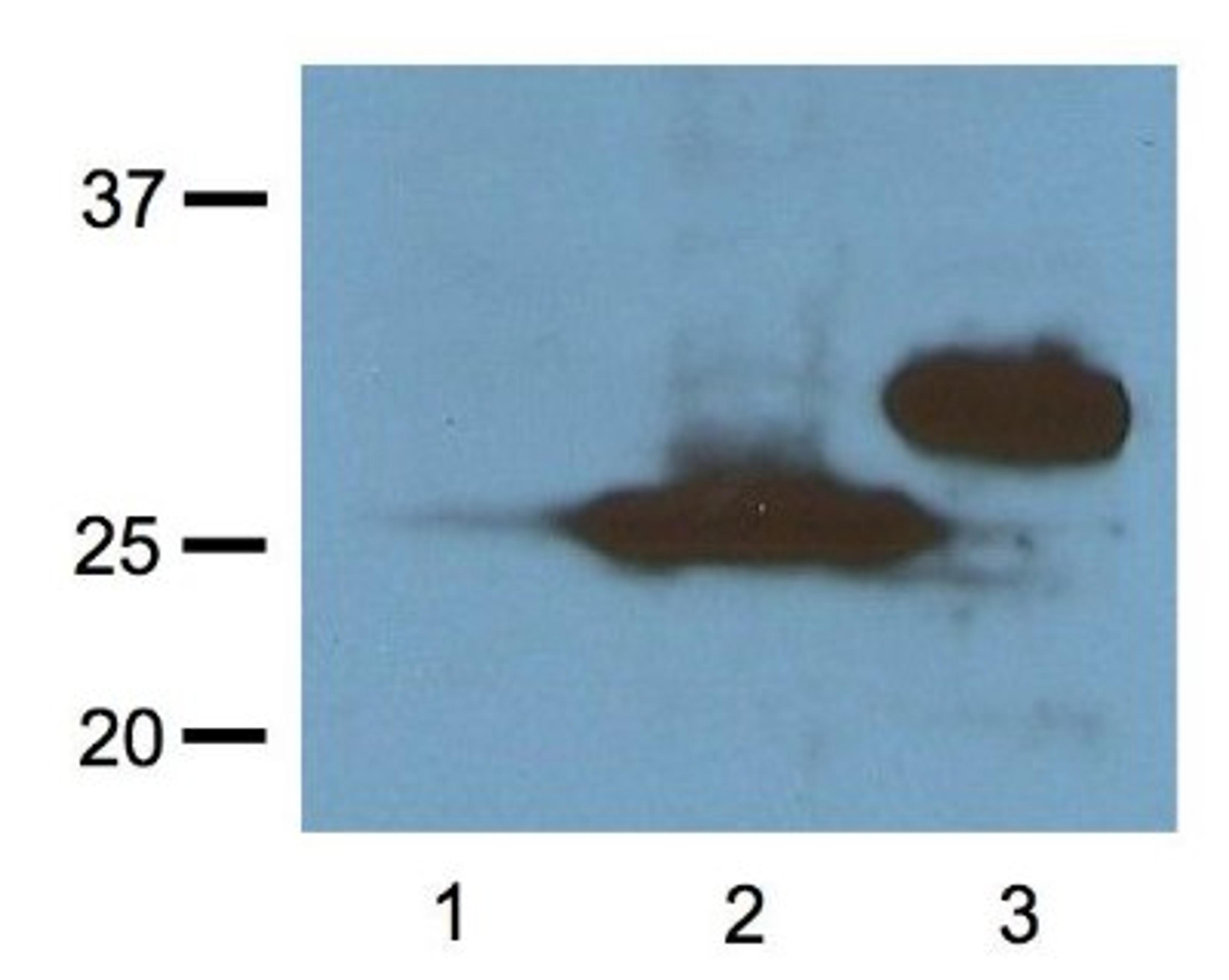 Western Blot: RFP Antibody (RF5R) [NBP2-37827] - Analysis of 1:1000 (1ug/mL) Ab dilution probed against HEK293 cells transfected with RFP-tagged protein vector; untransfected control (1), transfected with Turbo-RFP (2), and transfected with DeRed (3)