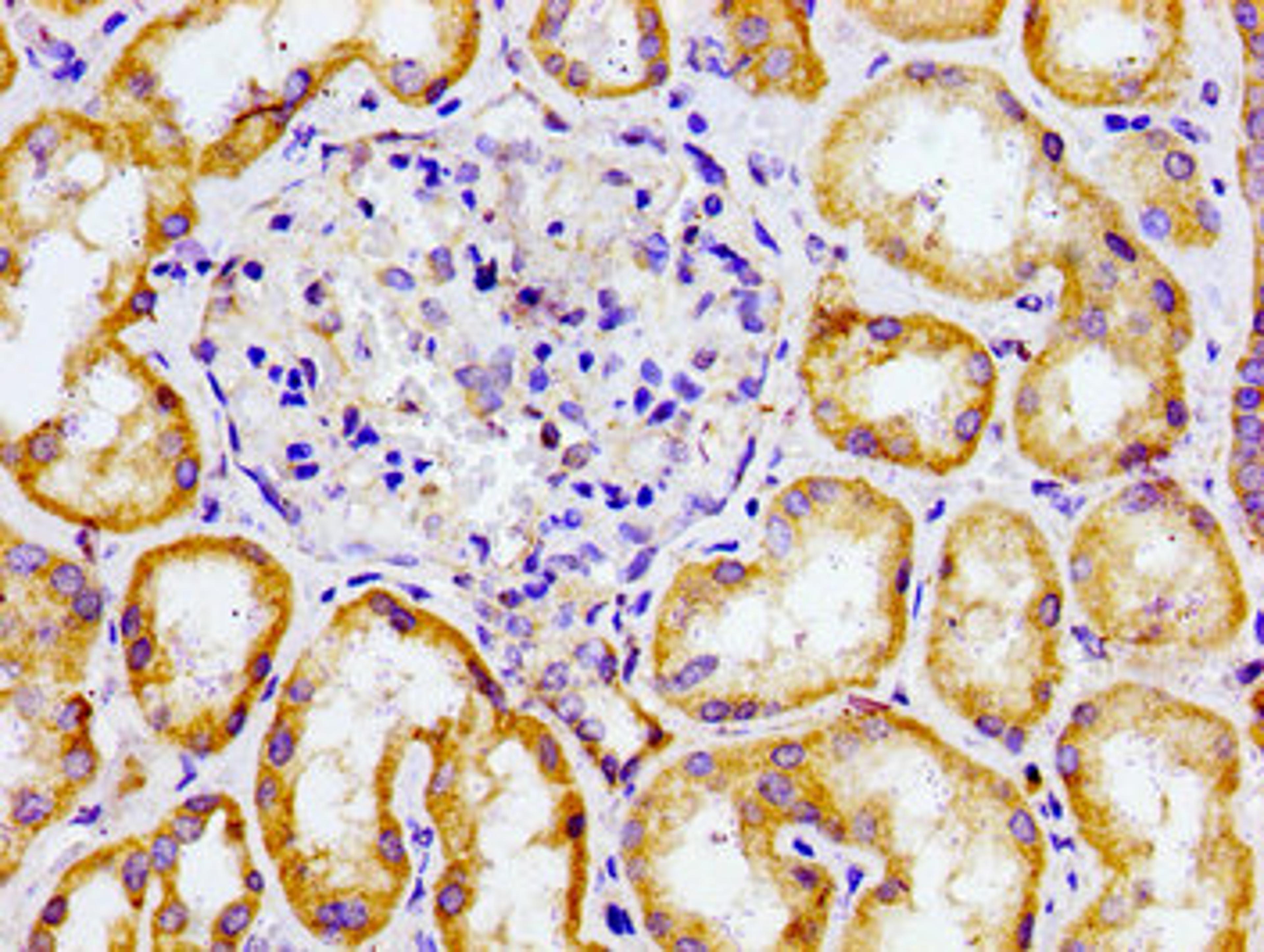 Immunohistochemistry of paraffin-embedded human kidney tissue using CSB-PA005614LA01HU at dilution of 1:100
