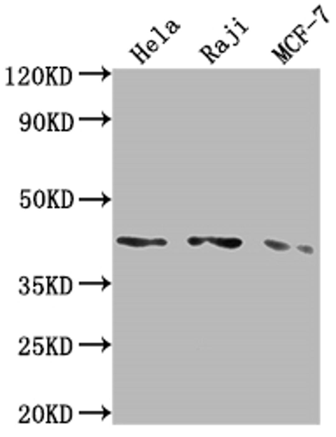 Western Blot. Positive WB detected in: Hela whole cell lysate, Raji whole cell lysate, MCF-7 whole cell lysate. All lanes: AGTR1 antibody at 1:2000. Secondary. Goat polyclonal to rabbit IgG at 1/50000 dilution. Predicted band size: 42 kDa. Observed band size: 42 kDa. 