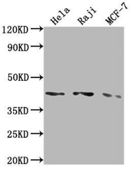 Western Blot. Positive WB detected in: Hela whole cell lysate, Raji whole cell lysate, MCF-7 whole cell lysate. All lanes: AGTR1 antibody at 1:2000. Secondary. Goat polyclonal to rabbit IgG at 1/50000 dilution. Predicted band size: 42 kDa. Observed band size: 42 kDa. 