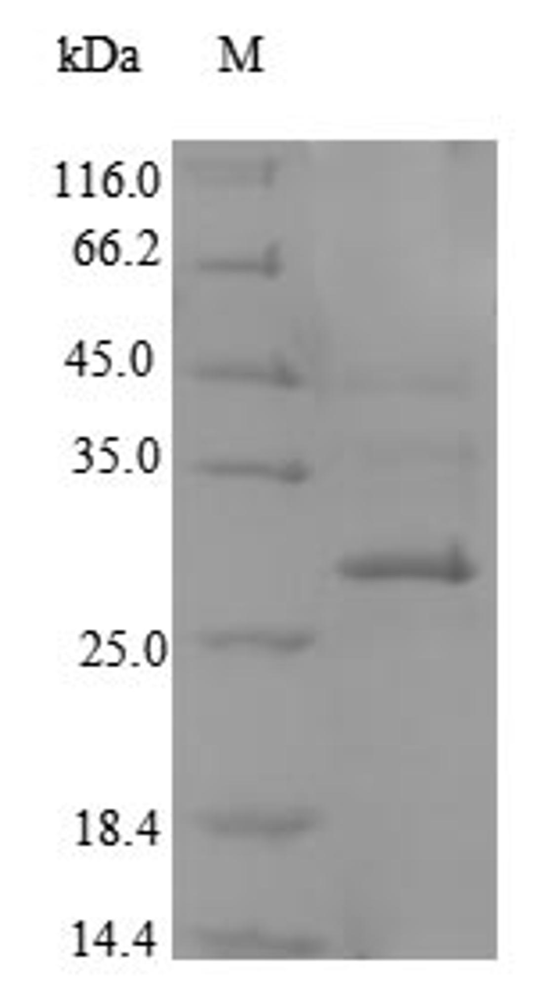 (Tris-Glycine gel) Discontinuous SDS-PAGE (reduced) with 5% enrichment gel and 15% separation gel.