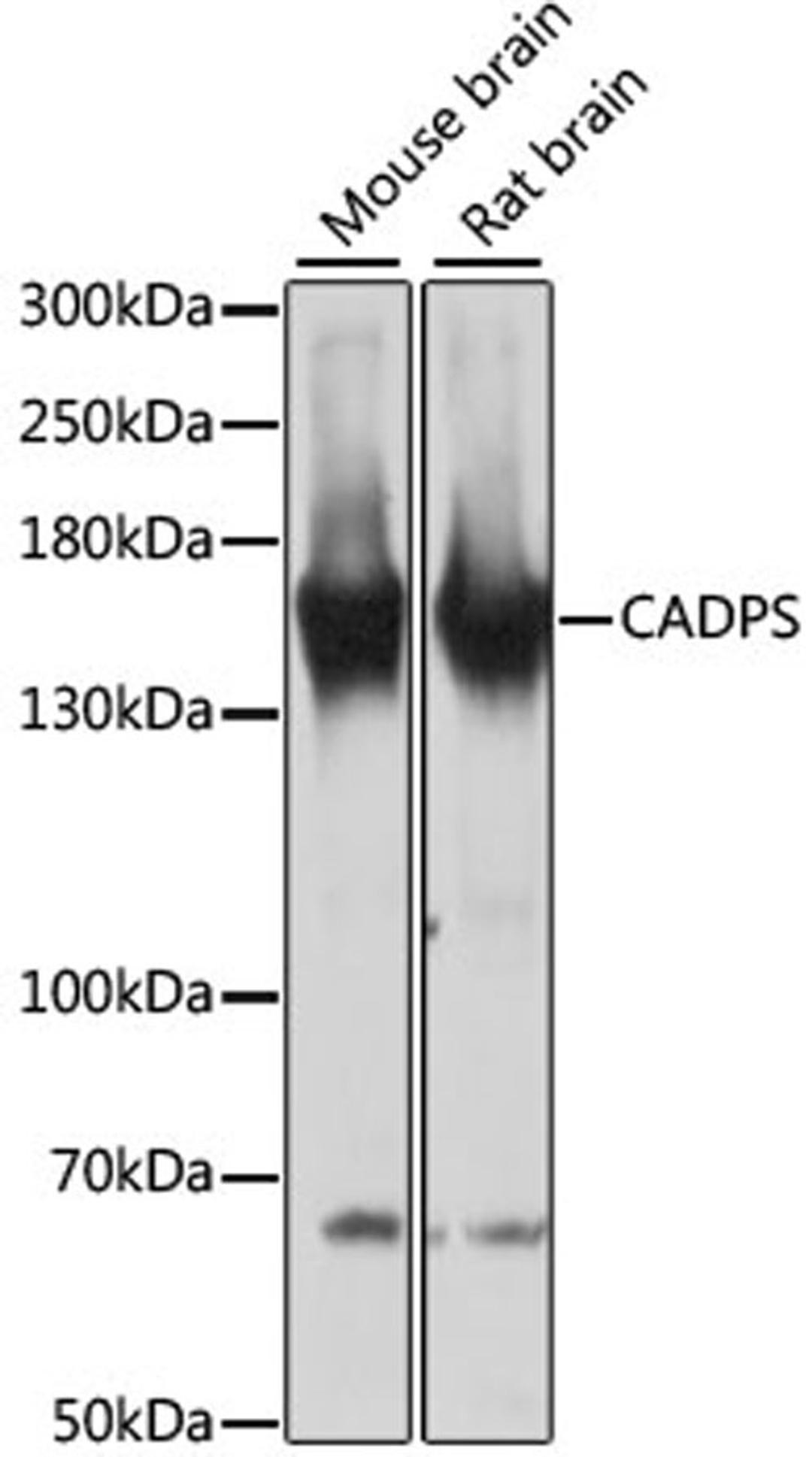 Western blot - CADPS antibody (A13186)