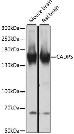 Western blot - CADPS antibody (A13186)