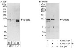 Detection of human CHD1L by western blot and immunoprecipitation.