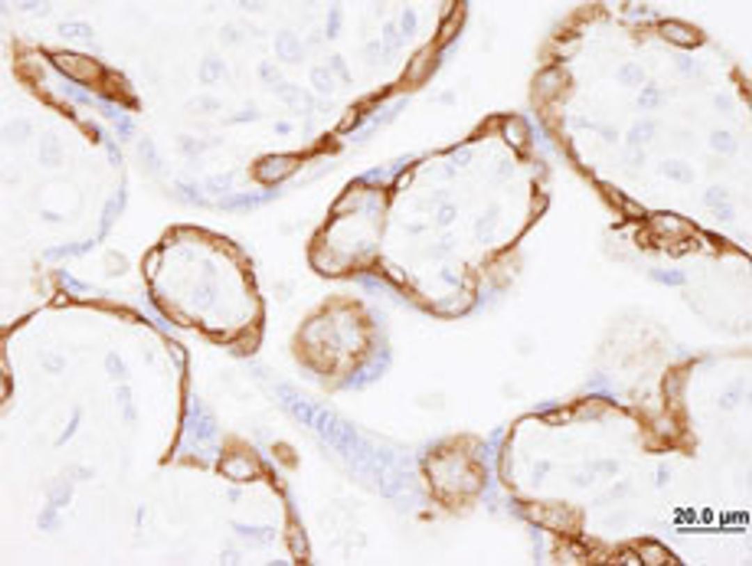 Detection of human EGFR by immunohistochemistry.