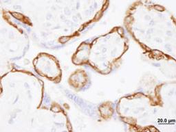 Detection of human EGFR by immunohistochemistry.