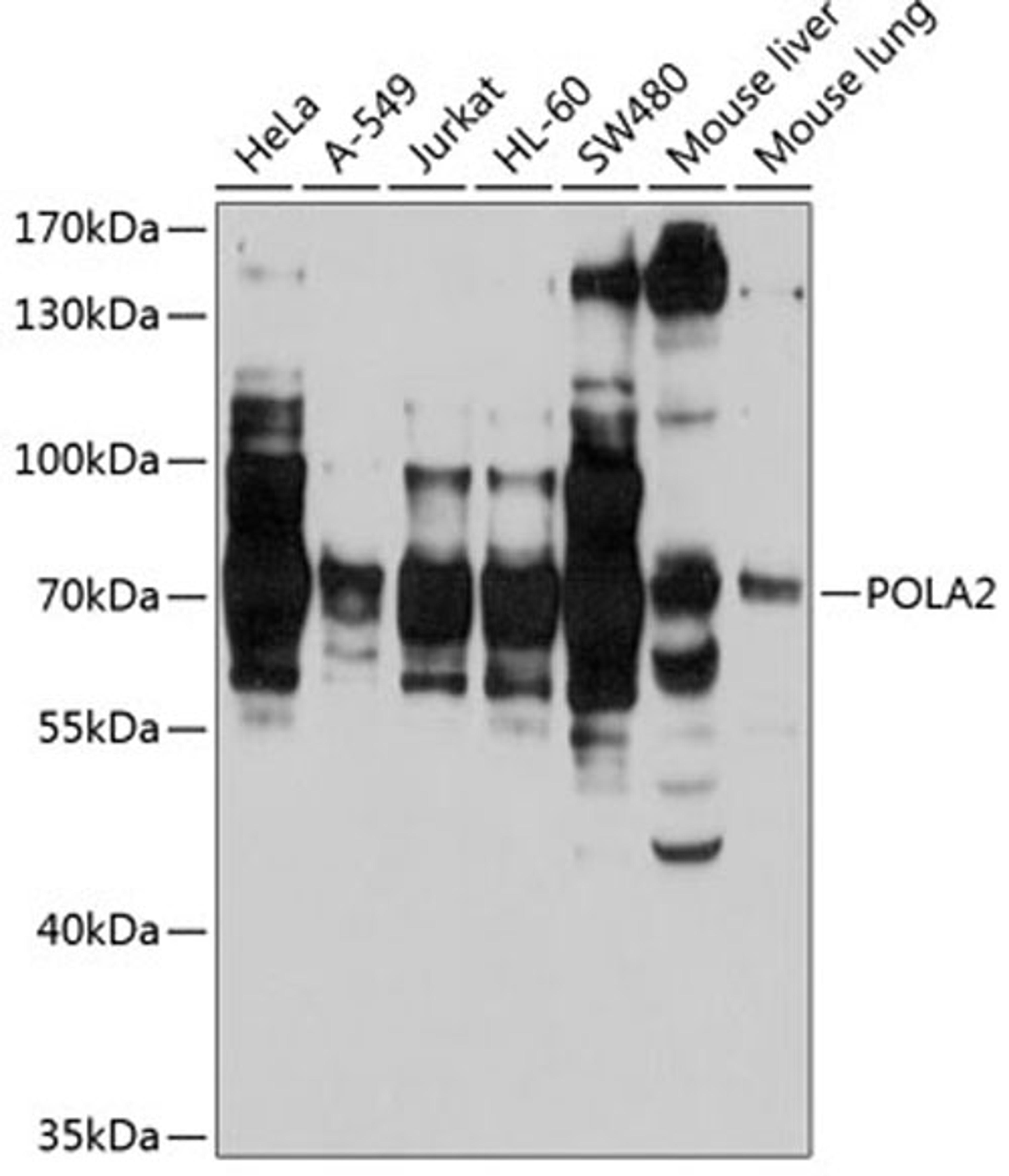 Western blot - POLA2 antibody (A3400)