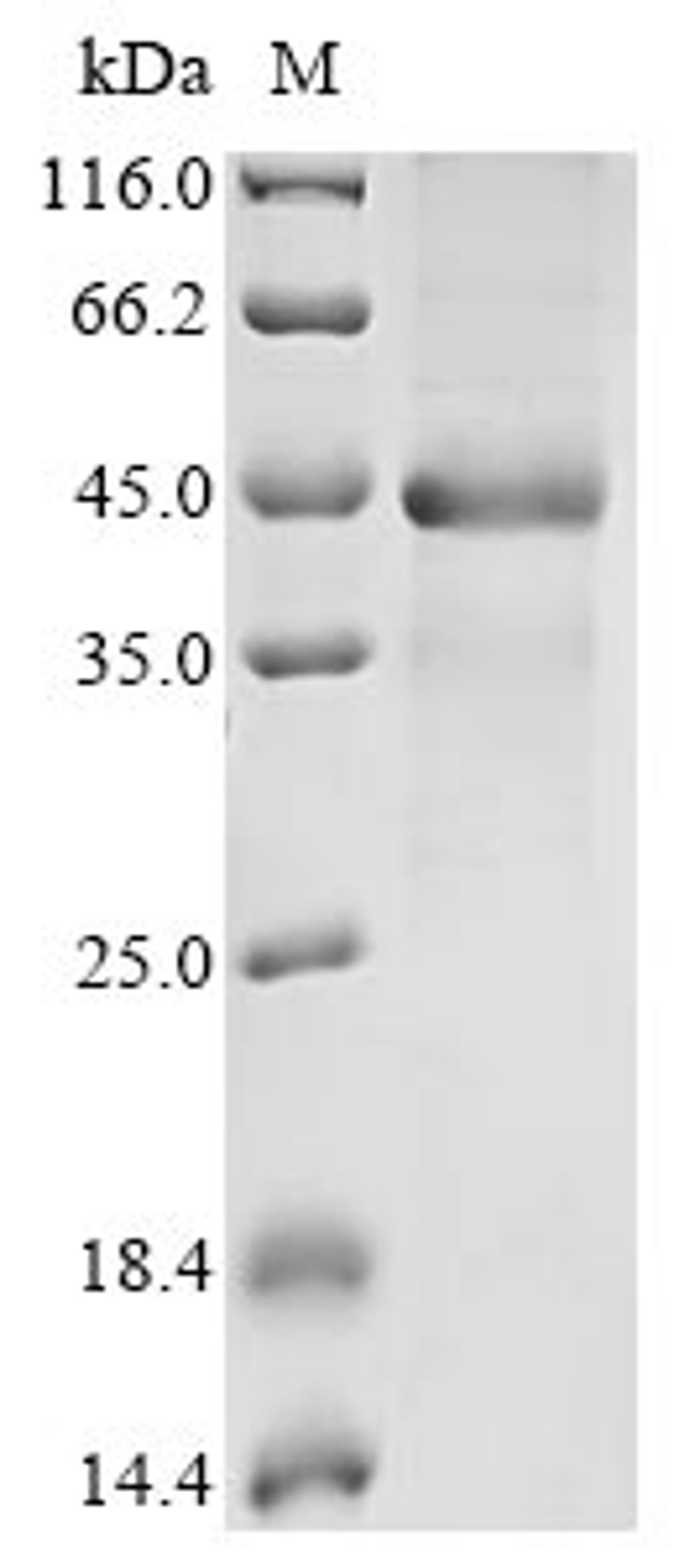 (Tris-Glycine gel) Discontinuous SDS-PAGE (reduced) with 5% enrichment gel and 15% separation gel.