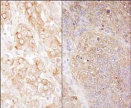 Detection of human and mouse eEF2 by immunohistochemistry.