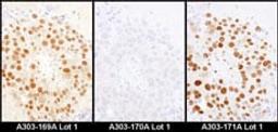 Detection of mouse HDGF by immunohistochemistry.