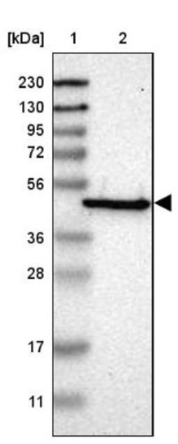 Western Blot: SQRDL Antibody [NBP1-84510] - Lane 1: Marker [kDa] 230, 130, 95, 72, 56, 36, 28, 17, 11<br/>Lane 2: Human cell line RT-4