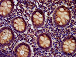 IHC image of CSB-PA744034LA01HU diluted at 1:400 and staining in paraffin-embedded human appendix tissue performed on a Leica BondTM system. After dewaxing and hydration, antigen retrieval was mediated by high pressure in a citrate buffer (pH 6.0). Section was blocked with 10% normal goat serum 30min at RT. Then primary antibody (1% BSA) was incubated at 4&deg;C overnight. The primary is detected by a biotinylated secondary antibody and visualized using an HRP conjugated SP system.