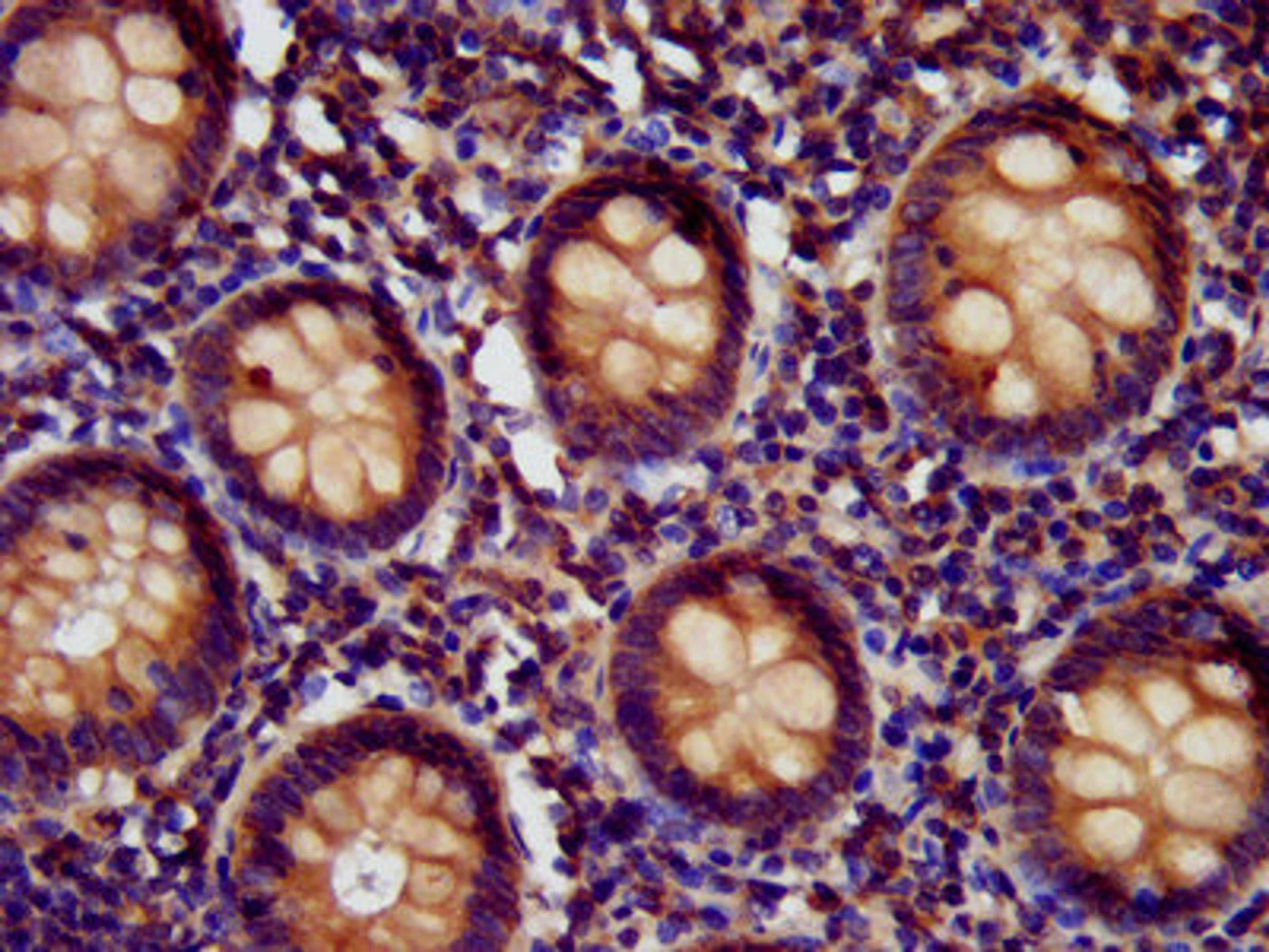 IHC image of CSB-PA744034LA01HU diluted at 1:400 and staining in paraffin-embedded human appendix tissue performed on a Leica BondTM system. After dewaxing and hydration, antigen retrieval was mediated by high pressure in a citrate buffer (pH 6.0). Section was blocked with 10% normal goat serum 30min at RT. Then primary antibody (1% BSA) was incubated at 4&deg;C overnight. The primary is detected by a biotinylated secondary antibody and visualized using an HRP conjugated SP system.