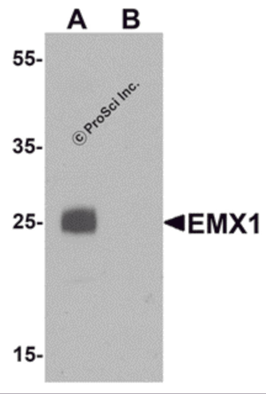 Western blot analysis of EMX1 in rat liver tissue lysate with EMX1 antibody at 1 μg/mL in (A) the absence and (B) the presence of blocking peptide.