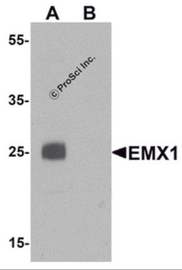 Western blot analysis of EMX1 in rat liver tissue lysate with EMX1 antibody at 1 μg/mL in (A) the absence and (B) the presence of blocking peptide.