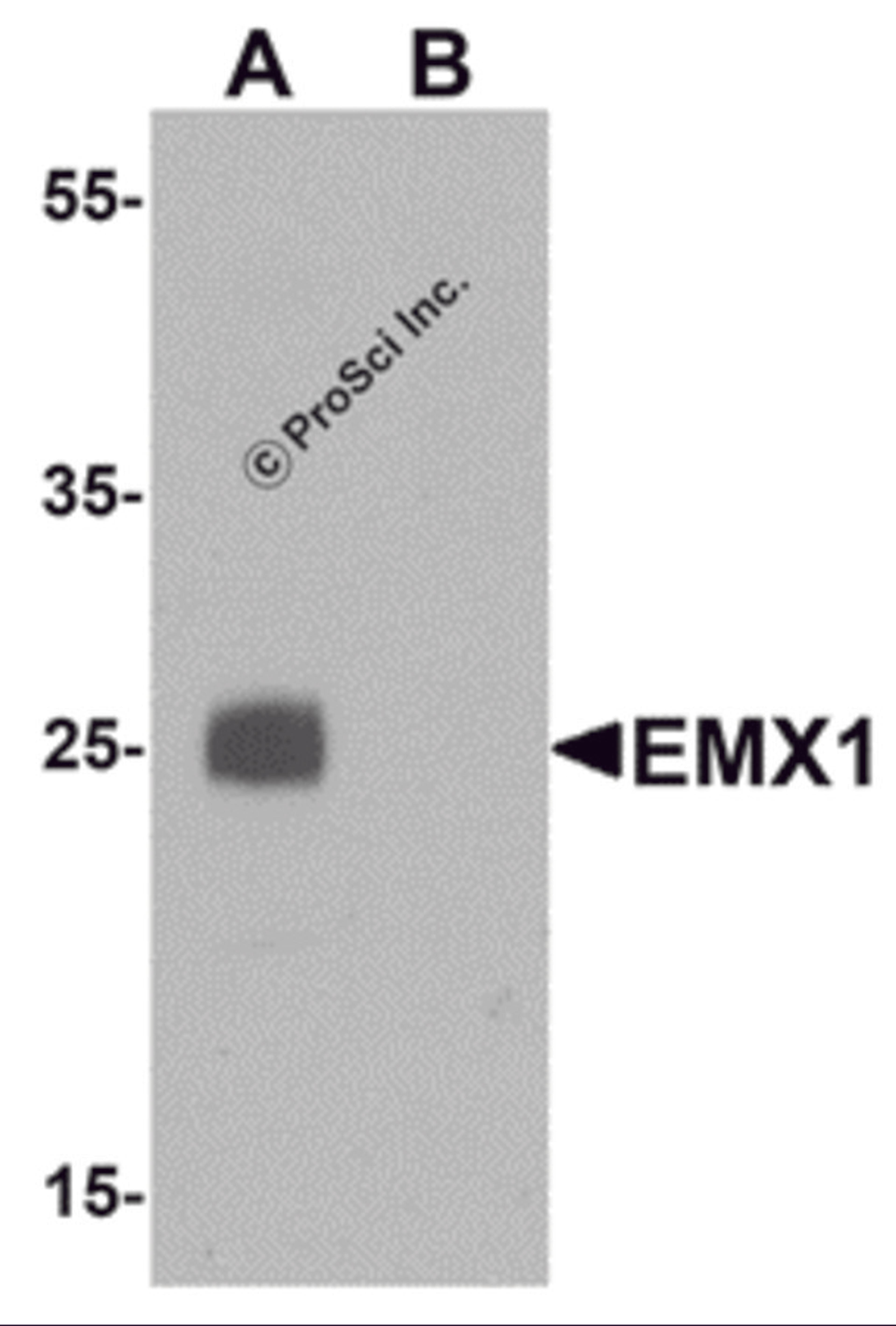 Western blot analysis of EMX1 in rat liver tissue lysate with EMX1 antibody at 1 μg/mL in (A) the absence and (B) the presence of blocking peptide.