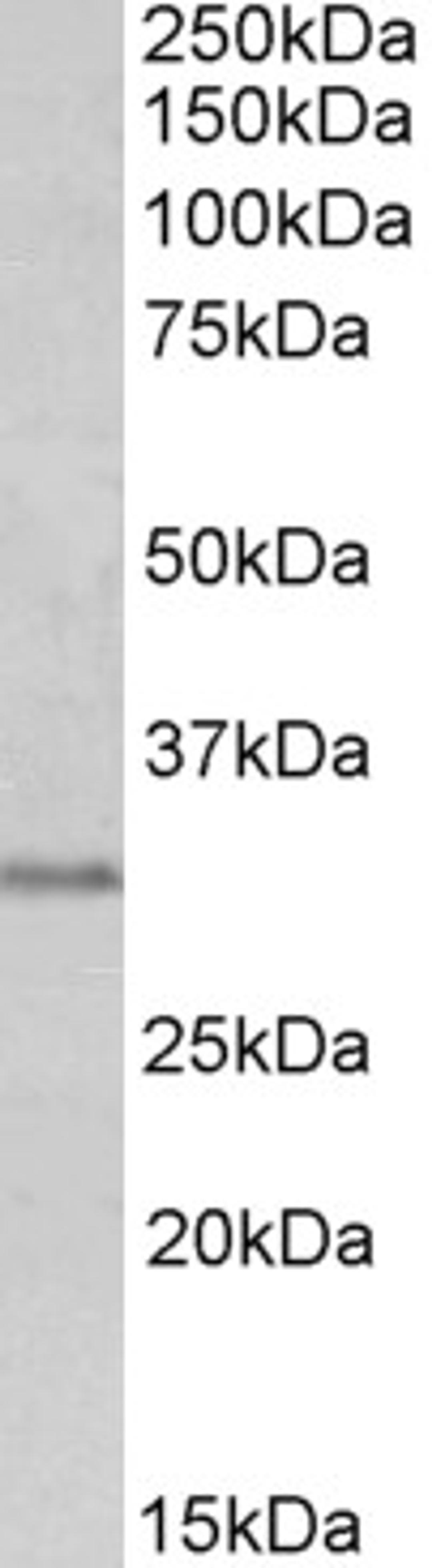 45-909 (0.3ug/ml) staining of Human Prostate lysate (35ug protein in RIPA buffer). Primary incubation was 1 hour. Detected by chemiluminescence.