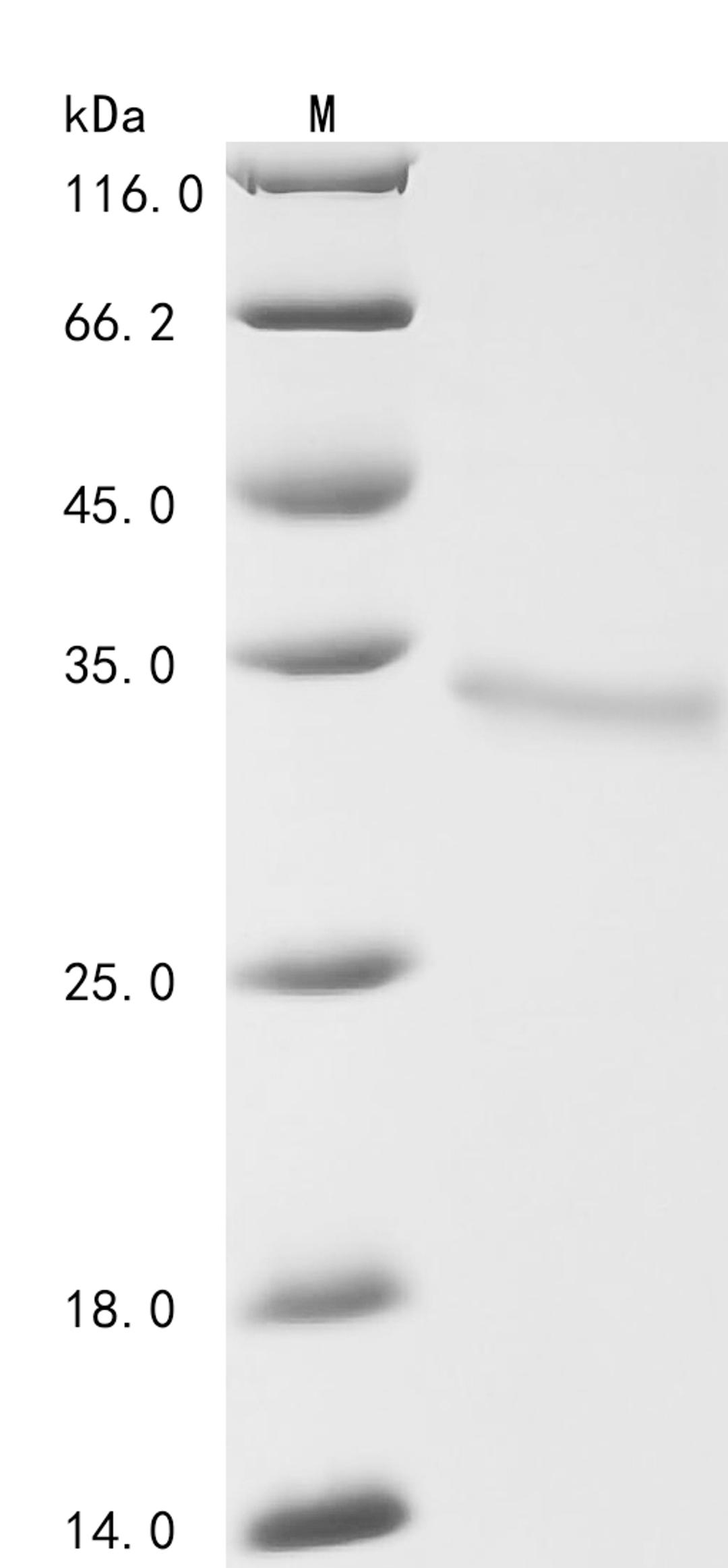 (Tris-Glycine gel) Discontinuous SDS-PAGE (reduced) with 5% enrichment gel and 15% separation gel.