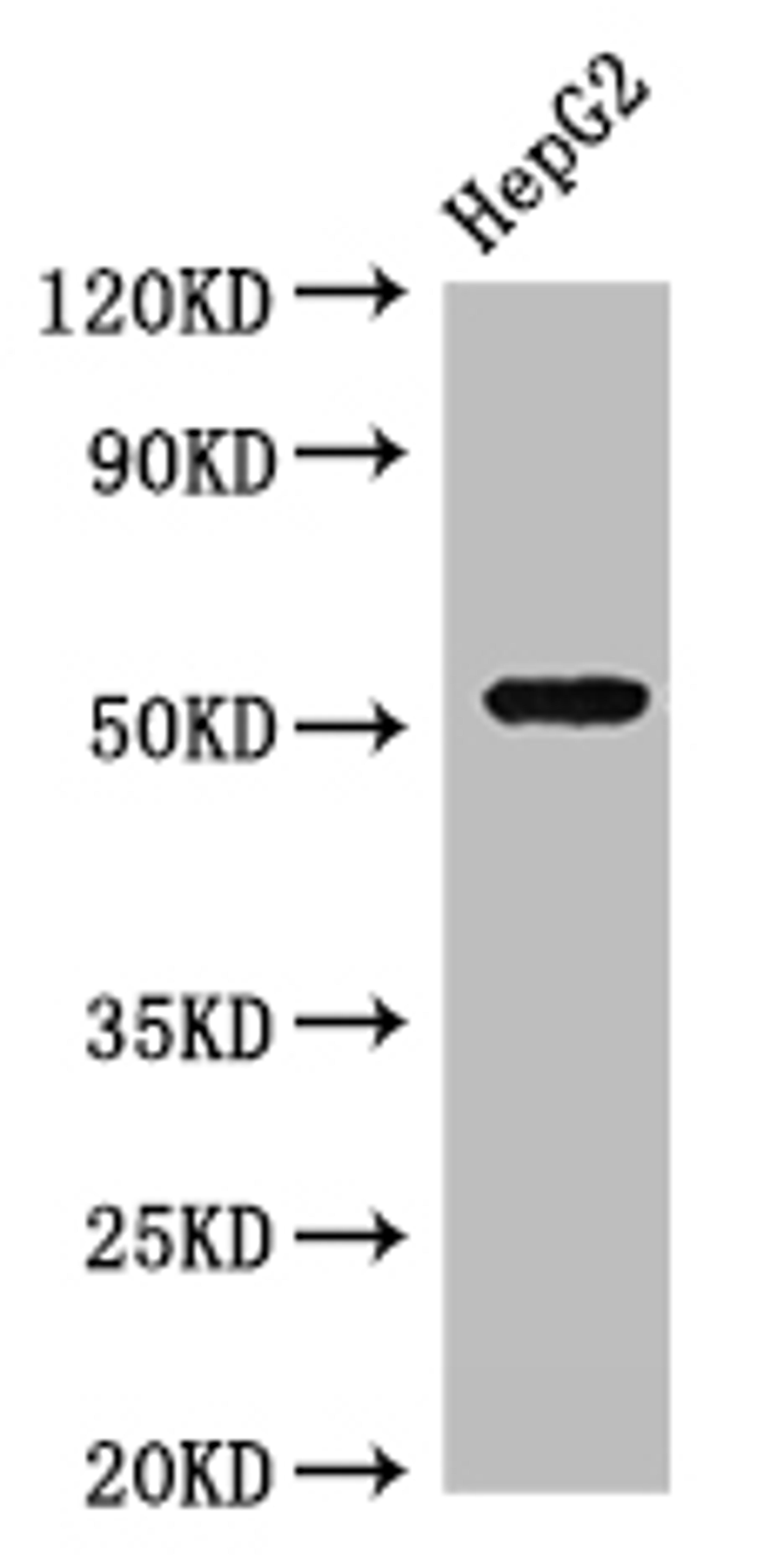 Western Blot. Positive WB detected in: HepG2 whole cell lysate. All lanes: GSK3A antibody at 3µg/ml. Secondary. Goat polyclonal to rabbit IgG at 1/50000 dilution. Predicted band size: 51 kDa. Observed band size: 51 kDa