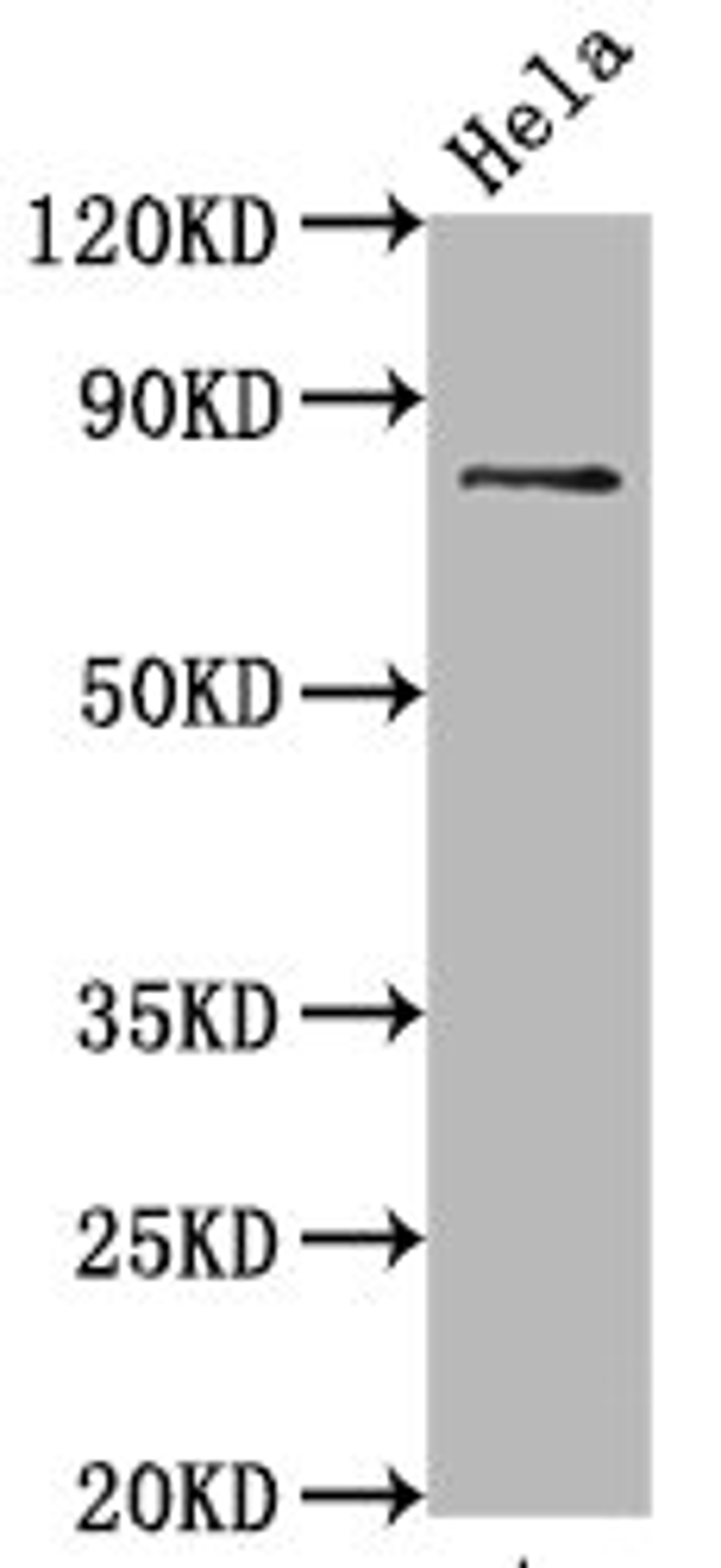 Western Blot. Positive WB detected in Hela whole cell lysate. All lanes Phospho-MAPT antibody at 0.67μg/ml. Secondary. Goat polyclonal to rabbit IgG at 1/50000 dilution. Predicted band size: 80 KDa. Observed band size: 80 KDa.