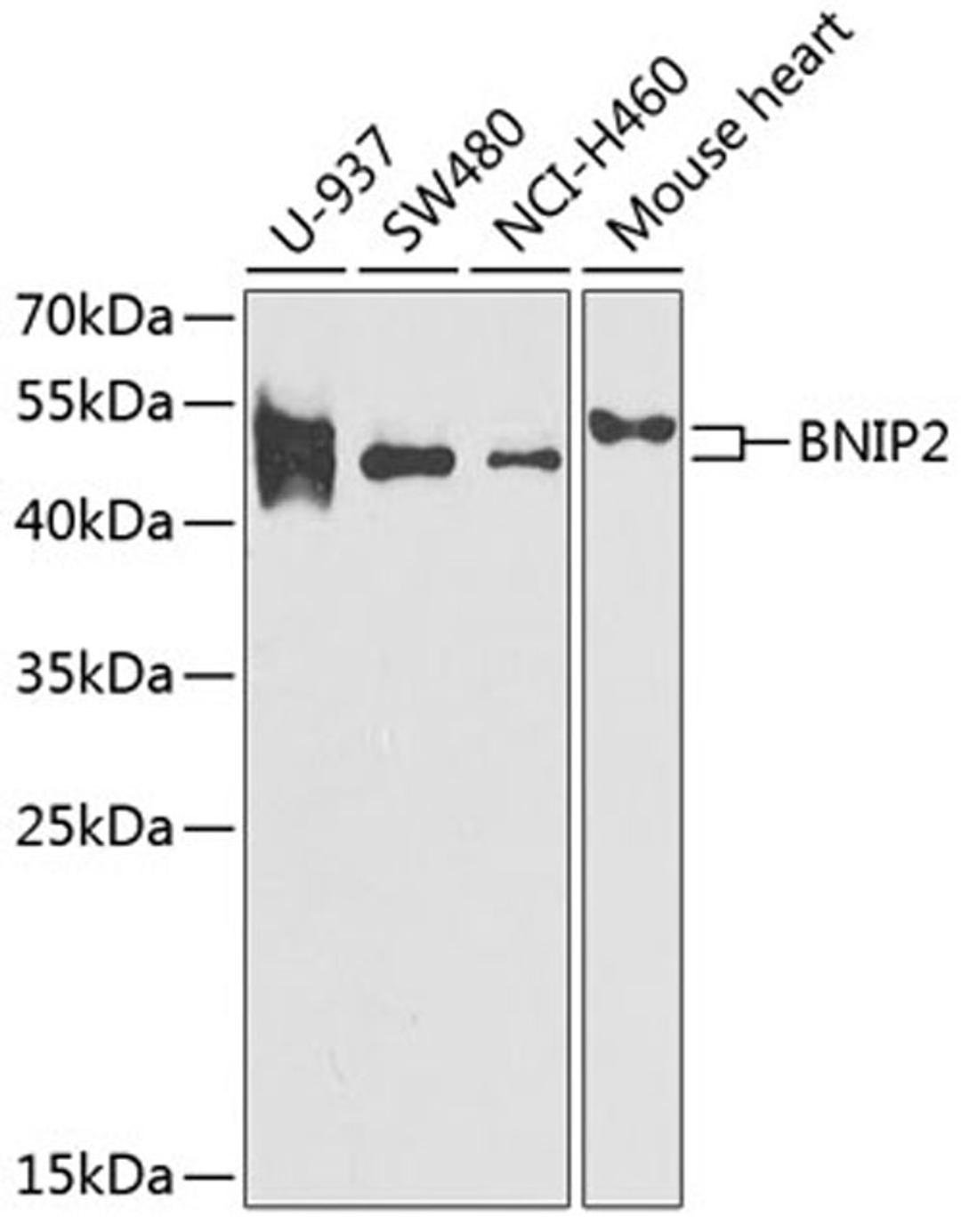 Western blot - BNIP2 antibody (A6282)