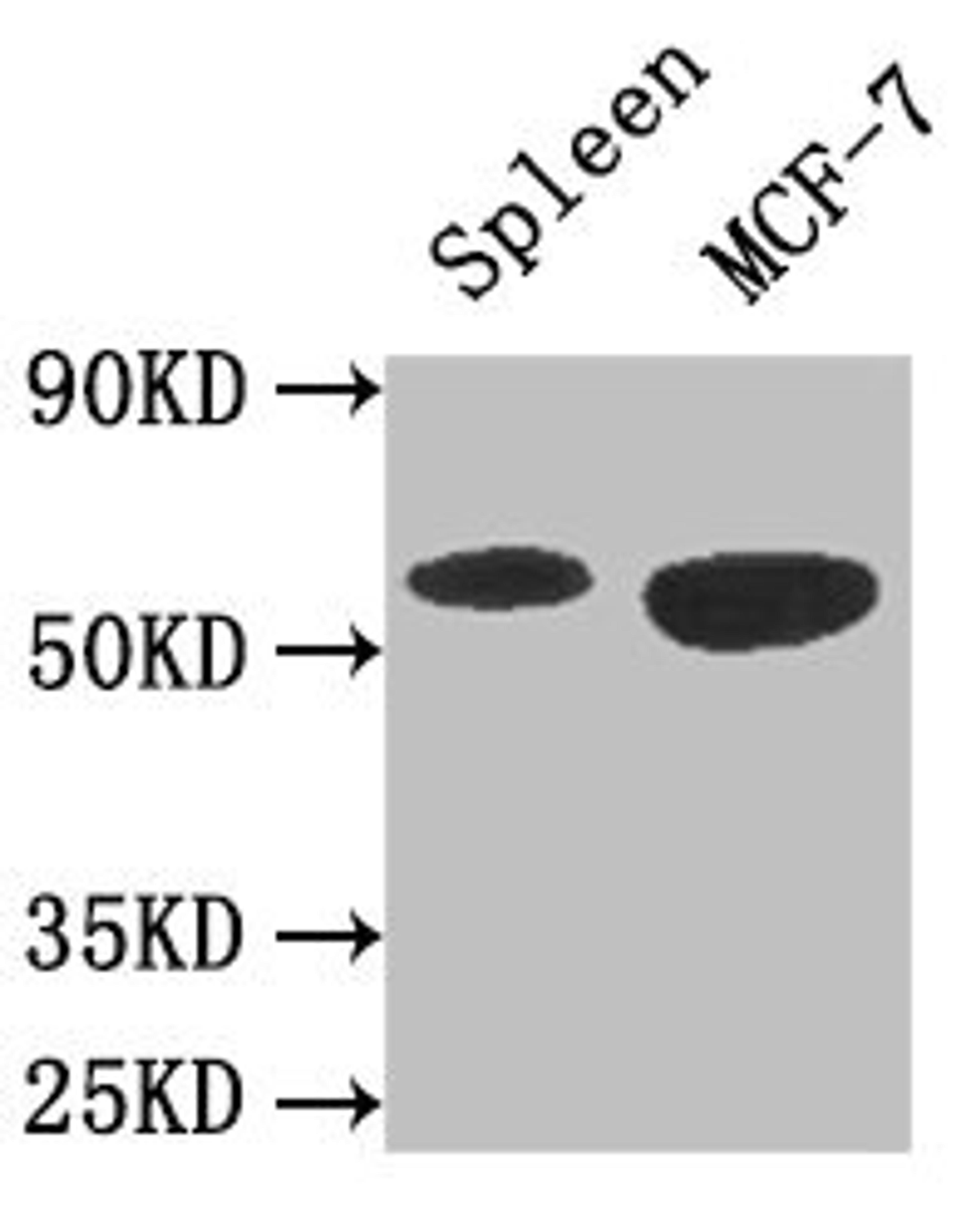 Western Blot. Positive WB detected in: Mouse spleen tissue, MCF-7 whole cell lysate. All lanes: AMPK1 antibody at 3ug/ml. Secondary. Goat polyclonal to rabbit IgG at 1/50000 dilution. Predicted band size: 65, 66 kDa. Observed band size: 65 kDa.