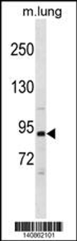 Western blot analysis in mouse lung tissue lysates (35ug/lane).This demonstrates the detected the Mouse Pik3r1 protein (arrow).