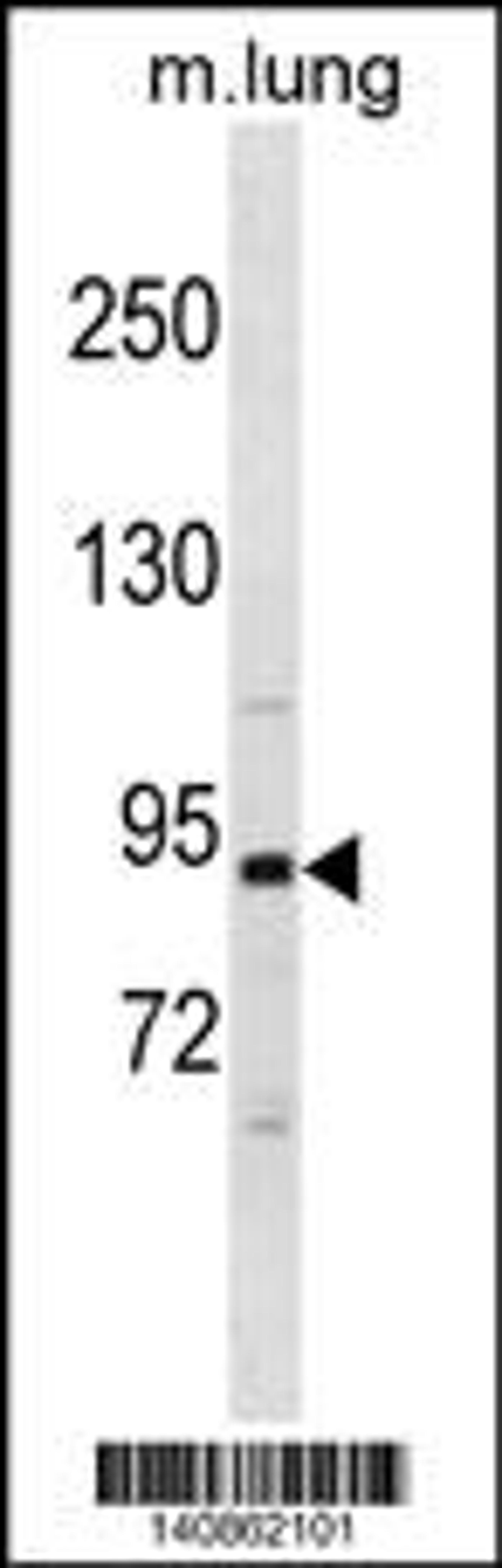 Western blot analysis in mouse lung tissue lysates (35ug/lane).This demonstrates the detected the Mouse Pik3r1 protein (arrow).