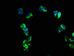 Immunofluorescence staining of PC-3 cells with CSB-PA02219A0Rb at 1:166, counter-stained with DAPI. The cells were fixed in 4% formaldehyde, permeabilized using 0.2% Triton X-100 and blocked in 10% normal Goat Serum. The cells were then incubated with the antibody overnight at 4&deg;C. The secondary antibody was Alexa Fluor 488-congugated AffiniPure Goat Anti-Rabbit IgG(H+L).
