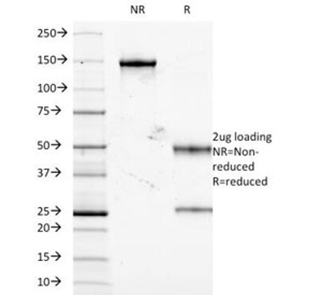 SDS-PAGE Analysis of Purified, BSA-Free TNF-alpha Antibody (clone J2D10). Confirmation of Integrity and Purity of the Antibody.