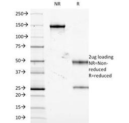 SDS-PAGE Analysis of Purified, BSA-Free TNF-alpha Antibody (clone J2D10). Confirmation of Integrity and Purity of the Antibody.