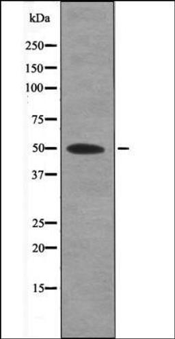 Western blot analysis of SK-OV3 whole cell lysates using MAP2K5 -Phospho-Thr315- antibody