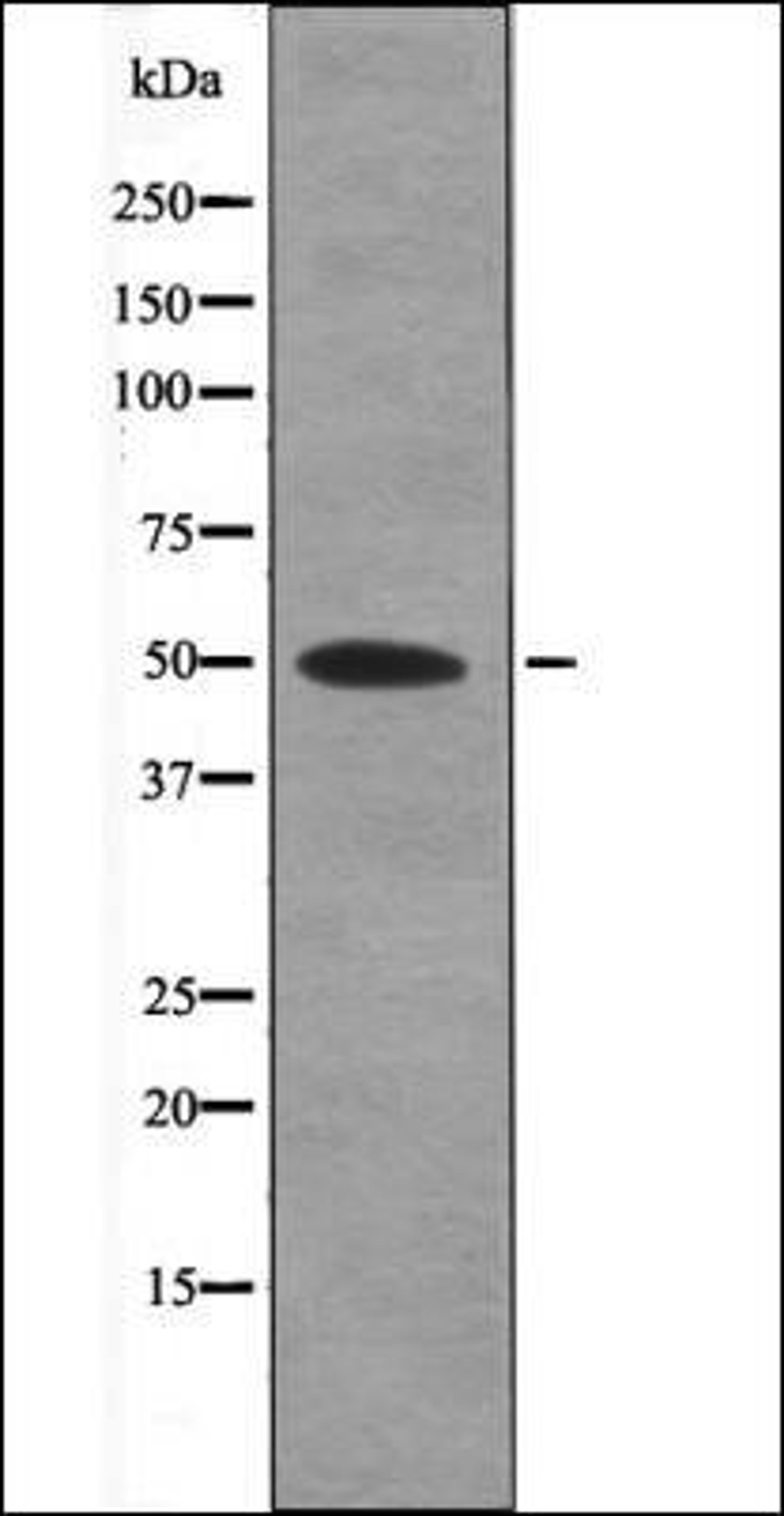 Western blot analysis of SK-OV3 whole cell lysates using MAP2K5 -Phospho-Thr315- antibody