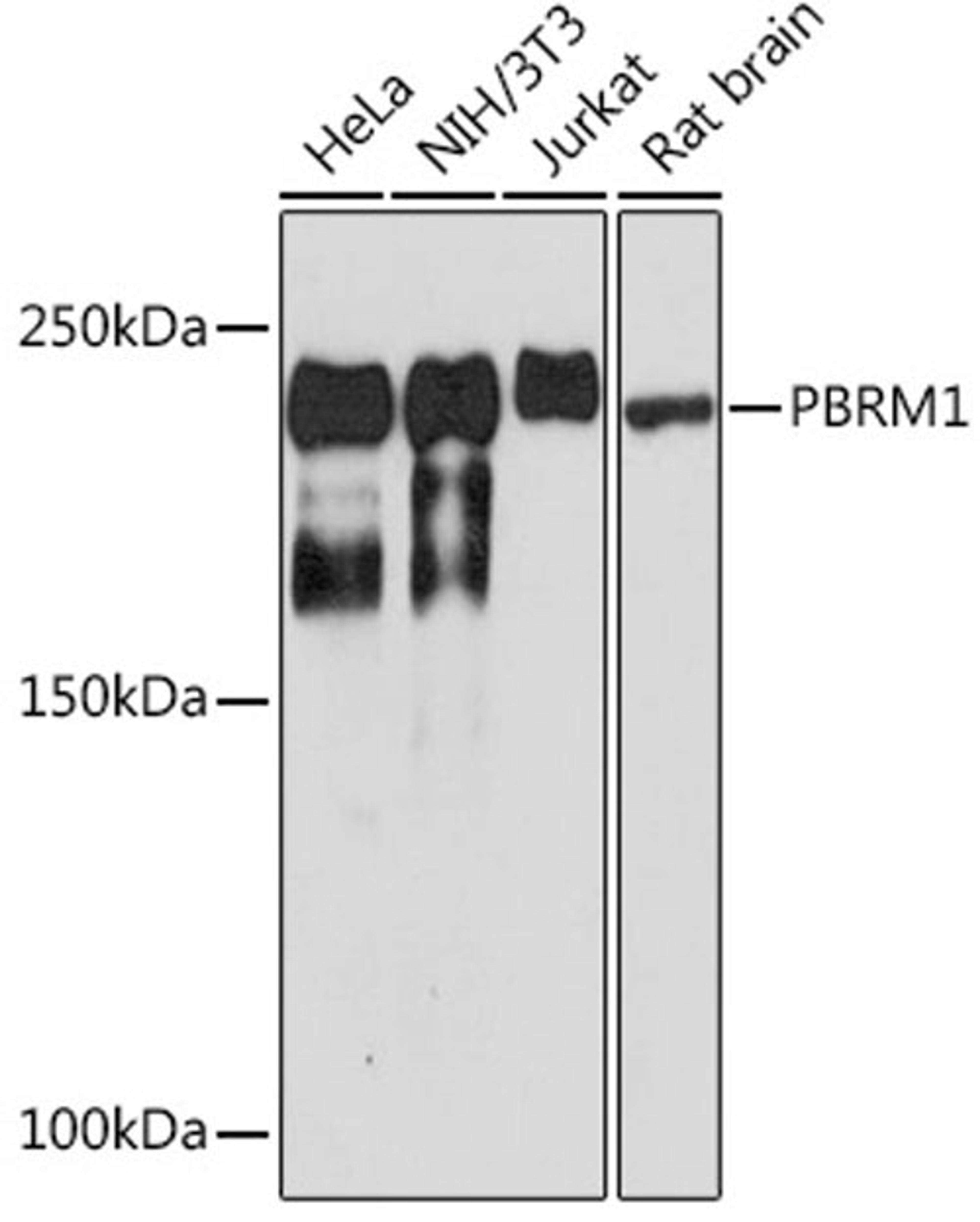 Western blot - PBRM1 Rabbit mAb (A0334)