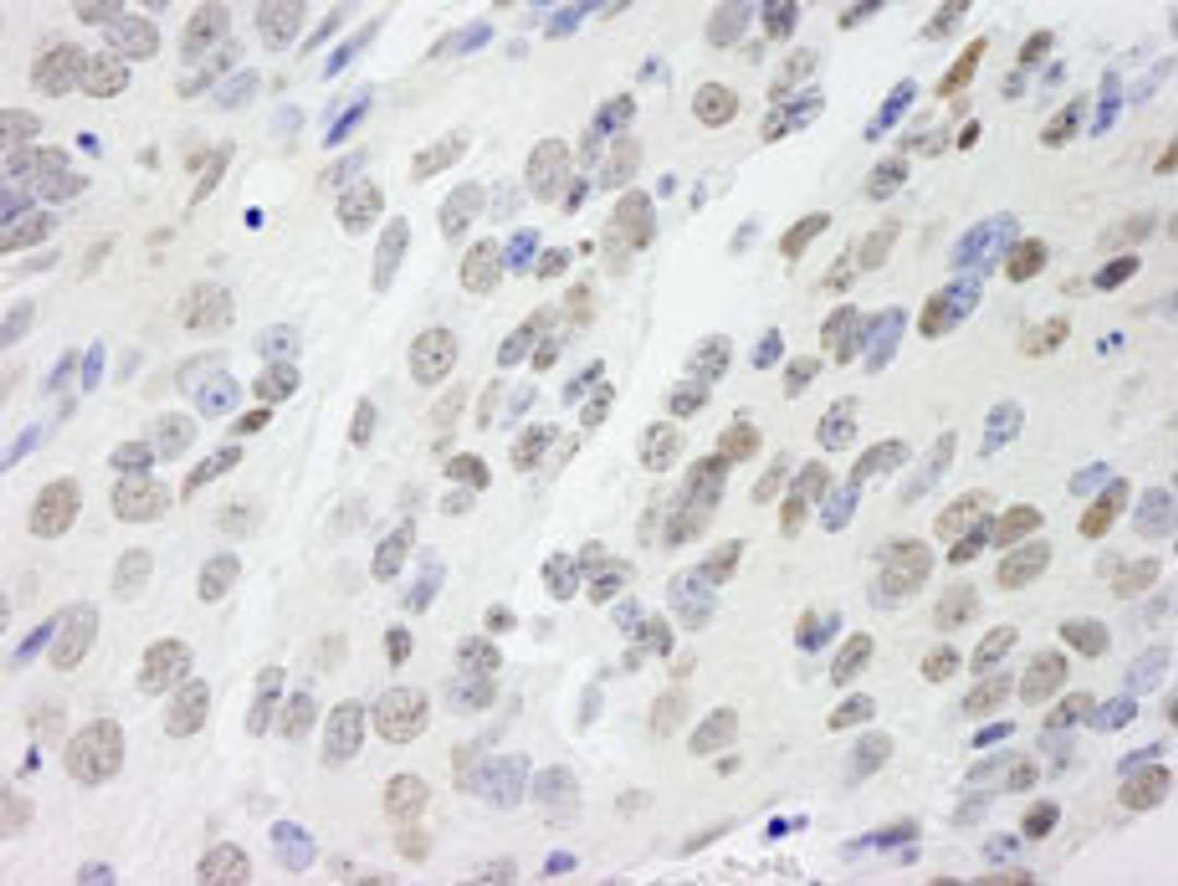 Detection of mouse NONO by immunohistochemistry.