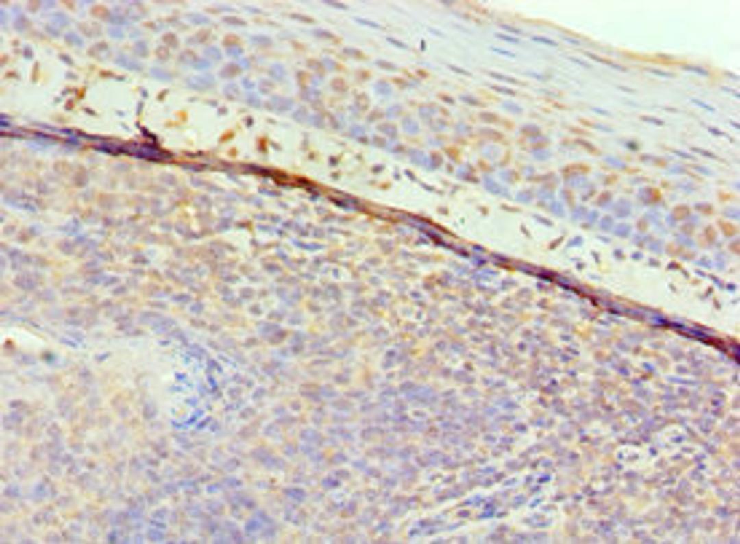 Immunohistochemistry of paraffin-embedded human tonsil tissue using CSB-PA009191ESR1HU at dilution of 1:100