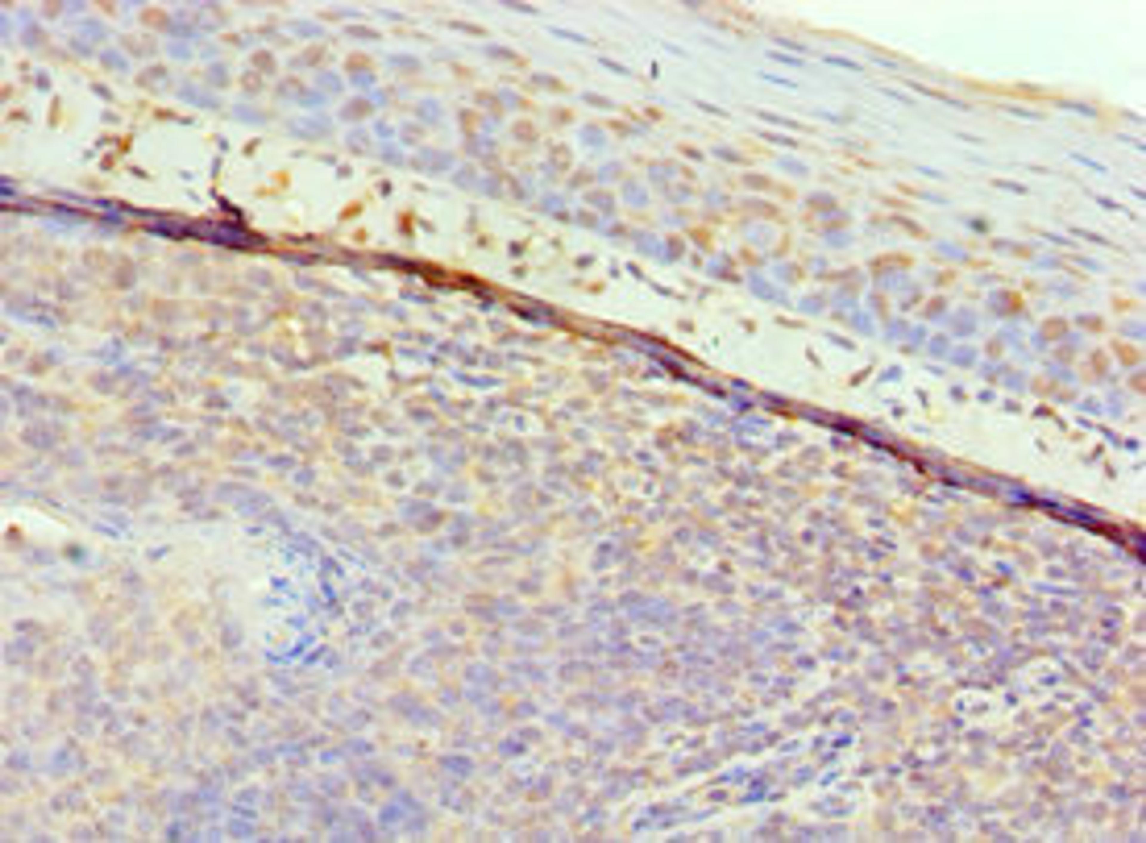 Immunohistochemistry of paraffin-embedded human tonsil tissue using CSB-PA009191ESR1HU at dilution of 1:100