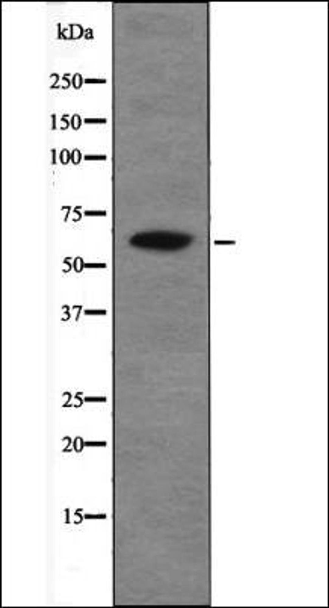 Western blot analysis of EGF treated HepG2 whole cell lysates using Chk2 -Phospho-Thr26+Ser28- antibody