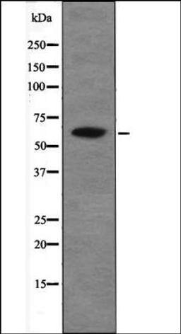 Western blot analysis of EGF treated HepG2 whole cell lysates using Chk2 -Phospho-Thr26+Ser28- antibody